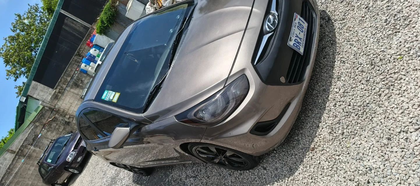 Hyundai Accent - Image 2